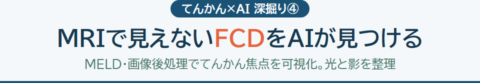 MRIで見えないFCDをAIが見つける サムネイル